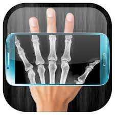 X Ray Scanner APK 2025